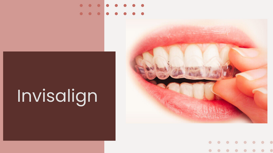 Orthodontics and Invisalign in Orlando: A New Era of Dental Health - Digytalia